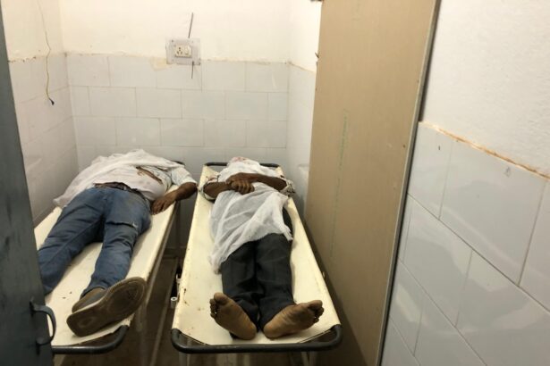 कांग्रेस नेता के भाई को लगी गोली